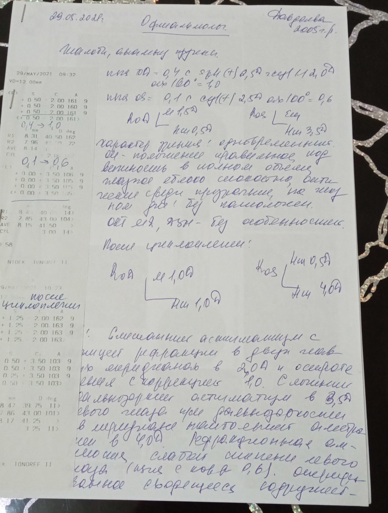 Эксимерлазерная коррекция зрения при сложном гиперметропическом астигматизме