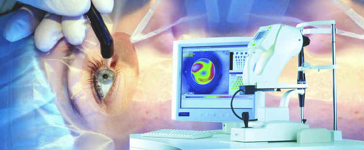 Коррекция зрения по методу iq lasik Коррекция зрения по методу iq lasik