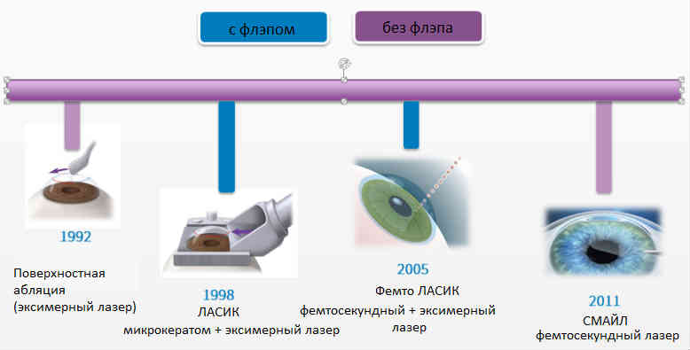 Лазерная коррекция зрения
